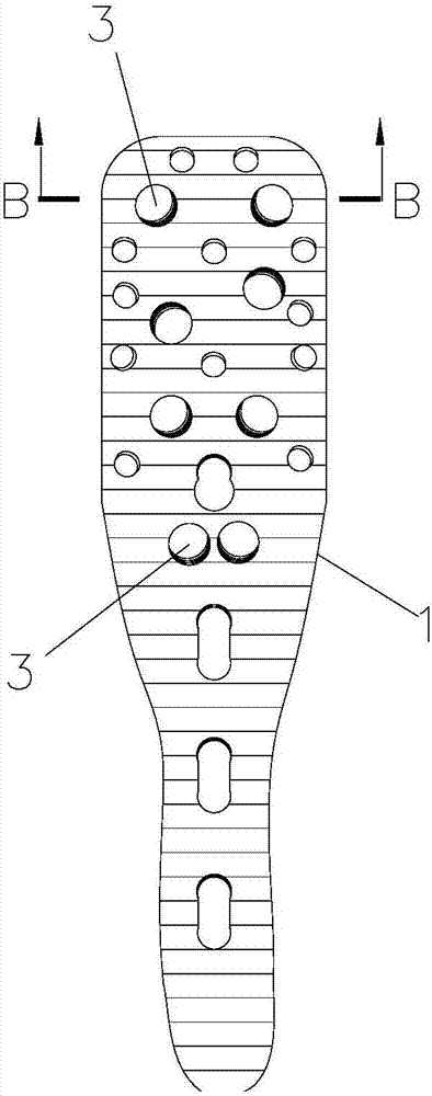 Multi-tooth bonesetting plate