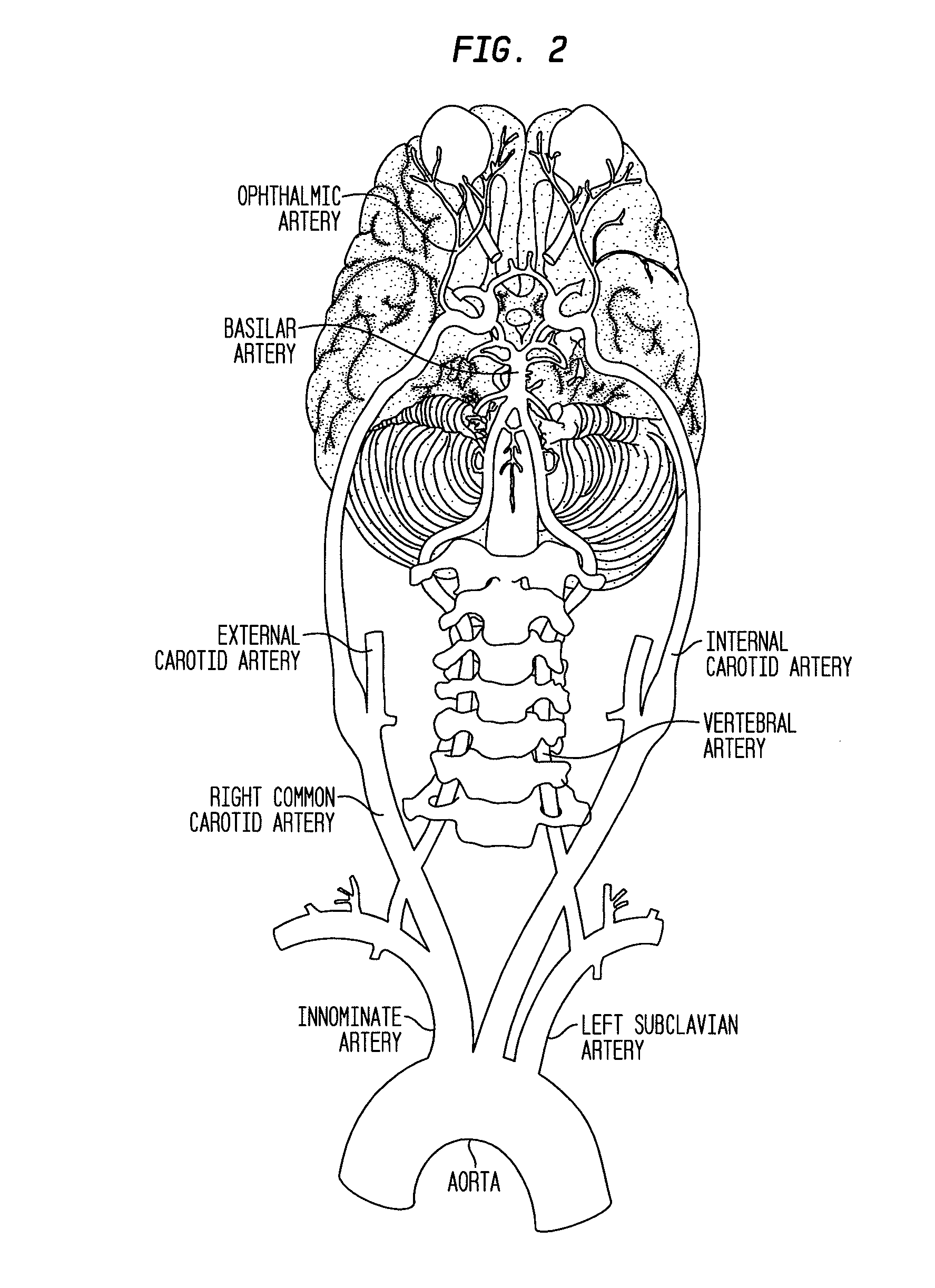 Compositions and methods for reducing visual loss