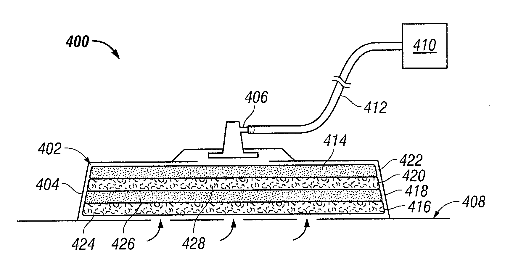 Fiber-microsphere bioresorbable composite scaffold for wound healing