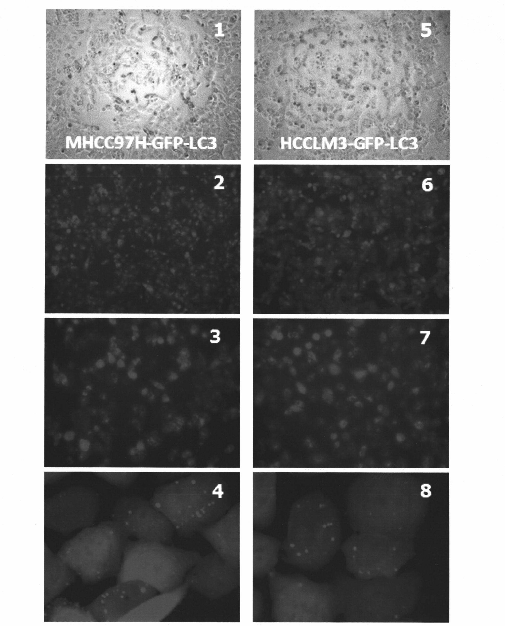 High metastatic potential hepatoma cell line capable of steady autophagy indication, and establishment method and application method thereof