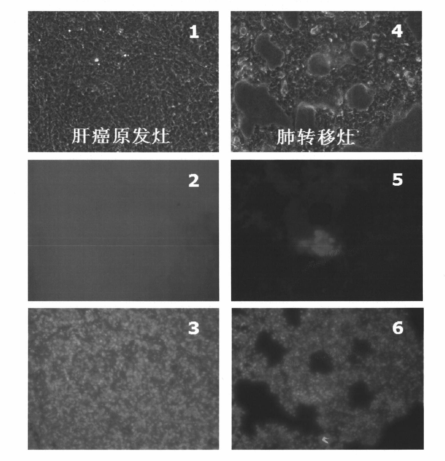 High metastatic potential hepatoma cell line capable of steady autophagy indication, and establishment method and application method thereof