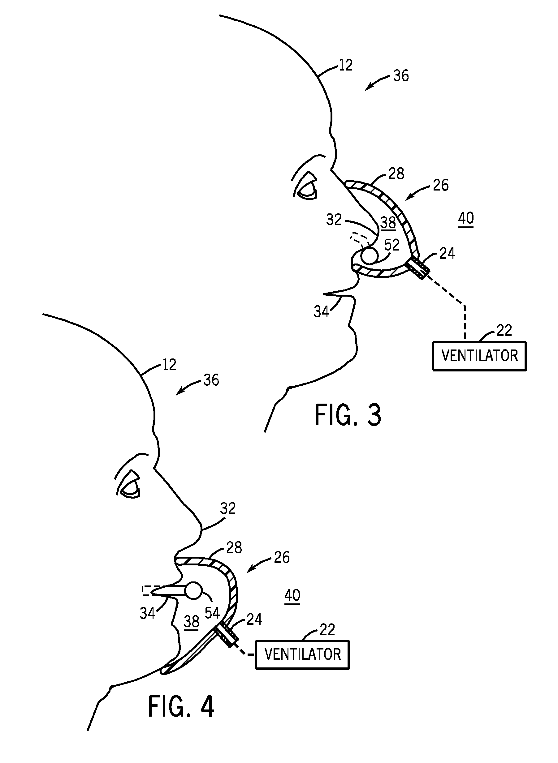 Respiratory monitoring with cannula receiving respiratory airflows and exhaled gases