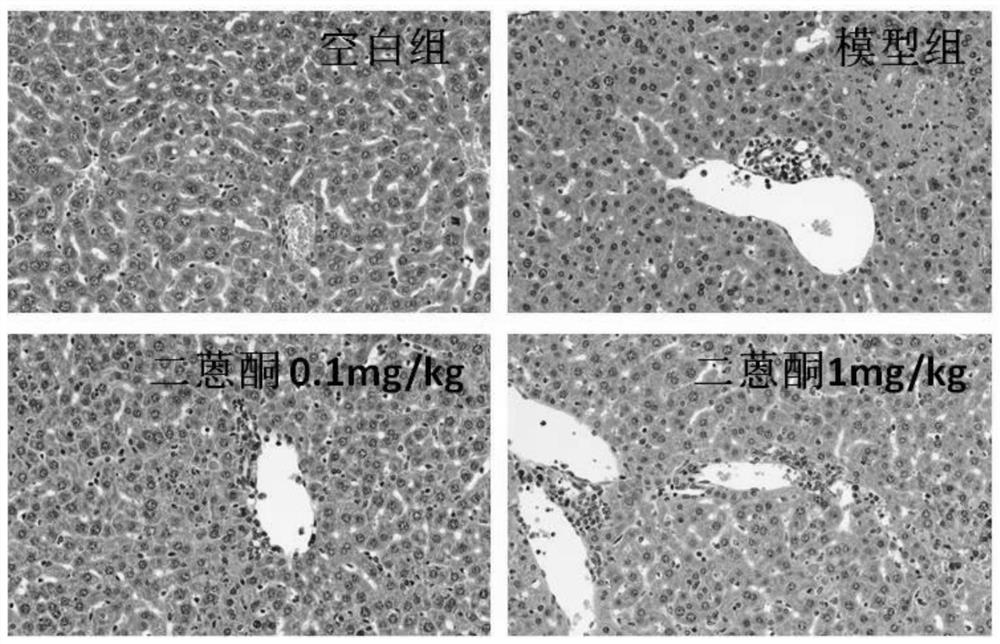 Application of dianthrone compound in preparation of anti-inflammatory and liver-protecting medicine