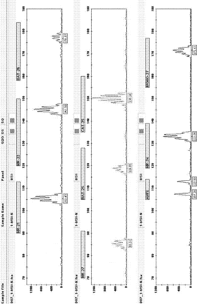 Tumor cell microsatellite instable state complex amplification system and detection kit