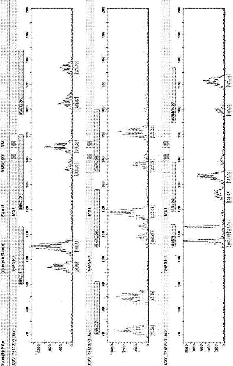 Tumor cell microsatellite instable state complex amplification system and detection kit