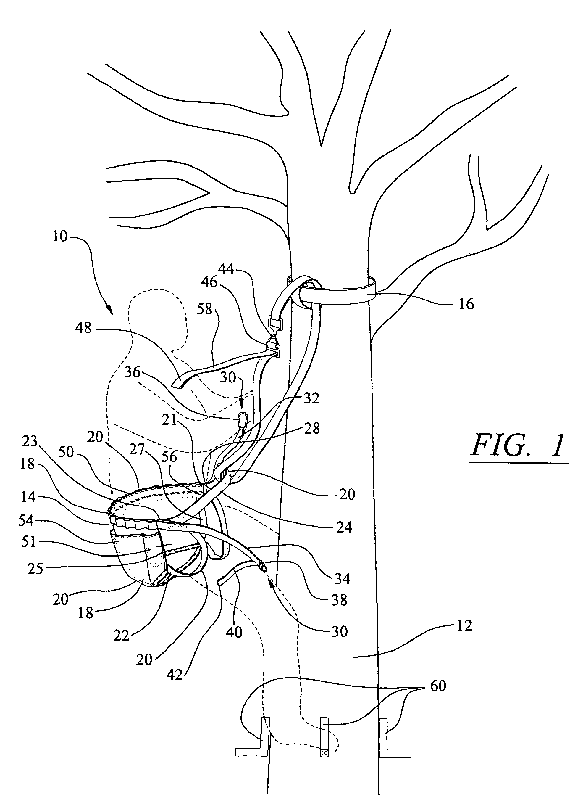 Support harness