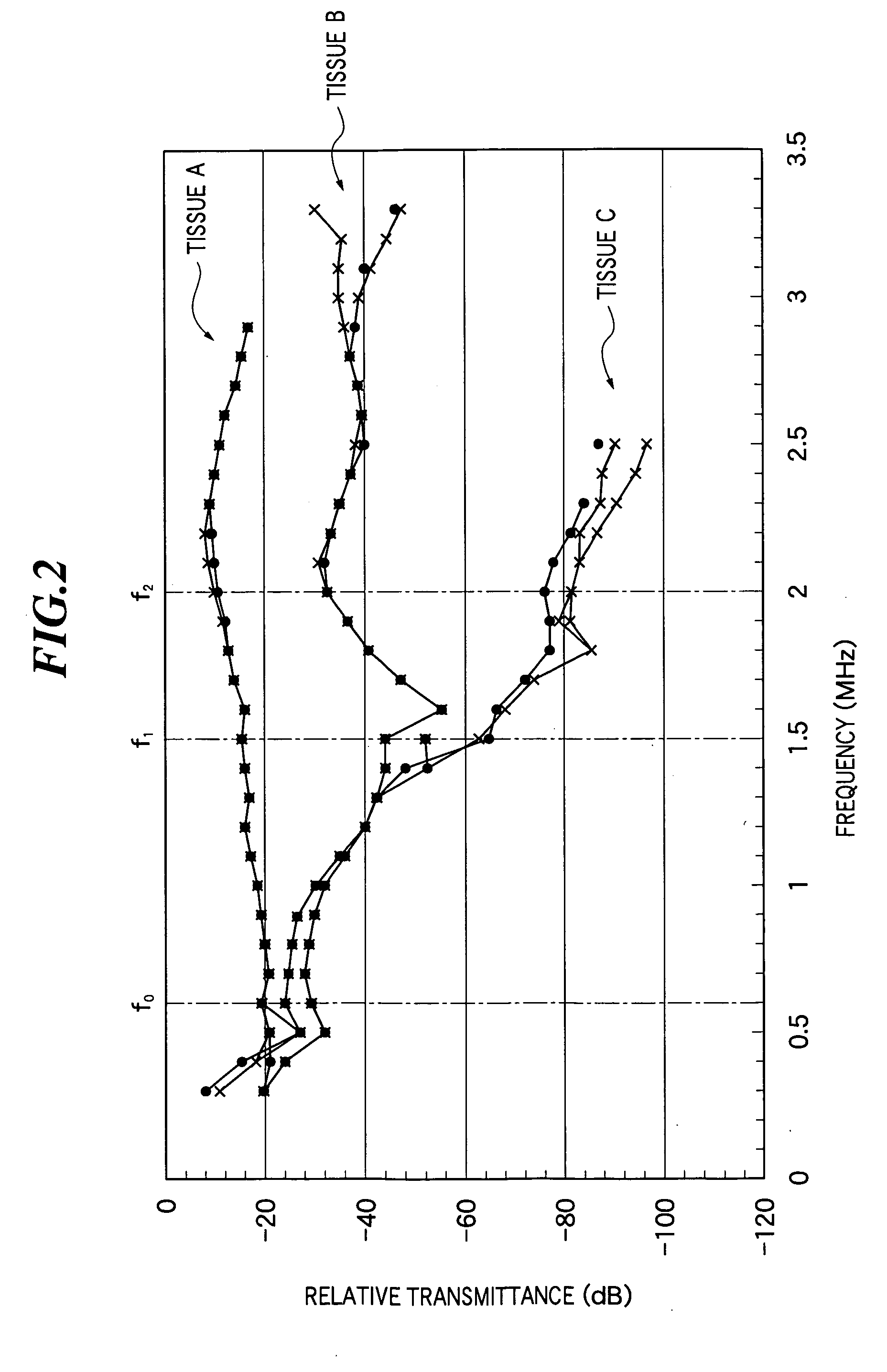 Ultrasonic imaging method and apparatus