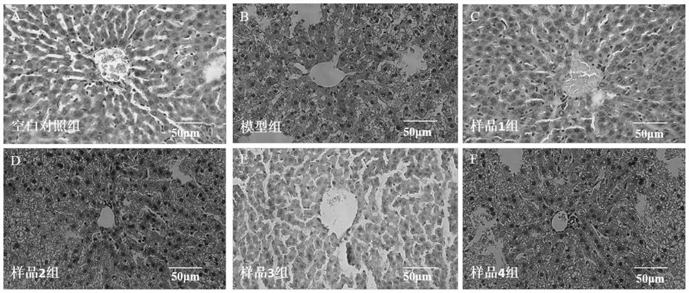 Extract composition with effects of protecting liver and lowering transaminase