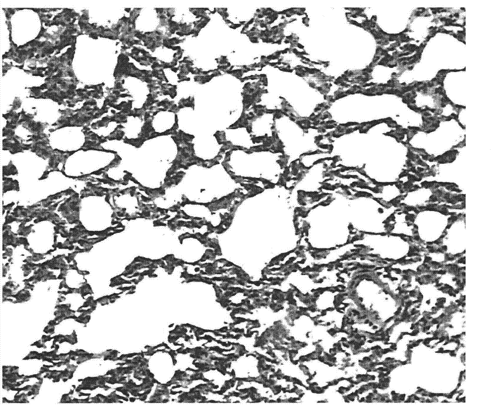 Application of osthole in preparation of medicament for preventing and treating pulmonary fibrosis