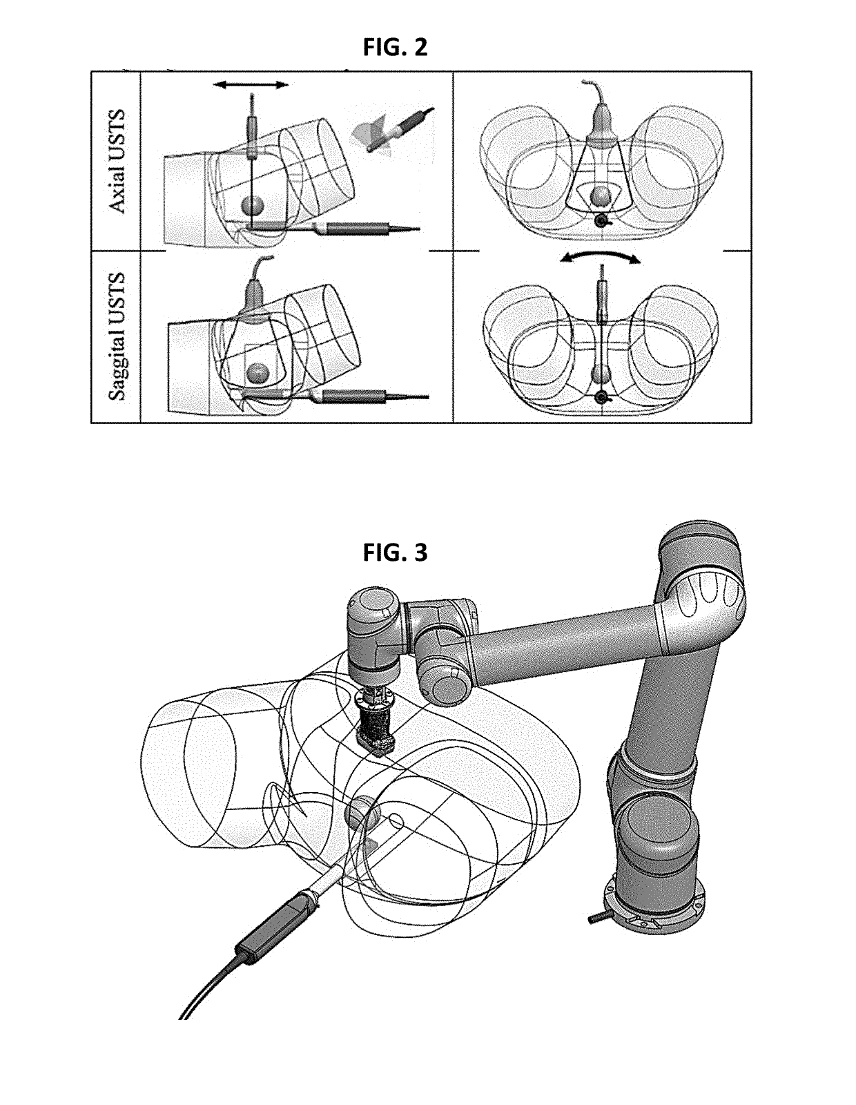 Tissue characterization with acoustic wave tomosynthesis