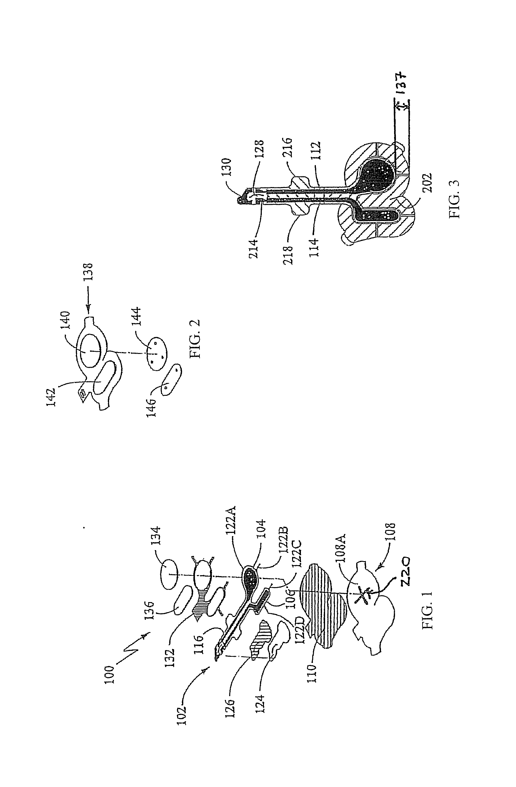 Indications for local transport of anaesthetic agents by electrotransport devices