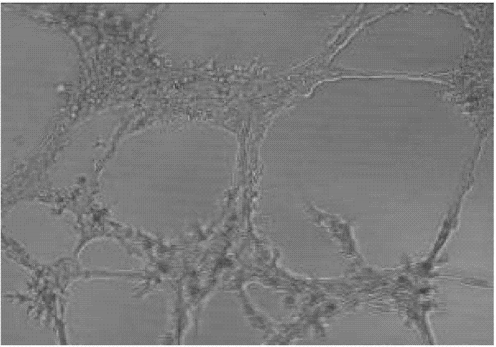 2-undecyl-3-methyl-hydroxyl-quinoline compound as well as preparation method, pharmaceutical composition and use thereof