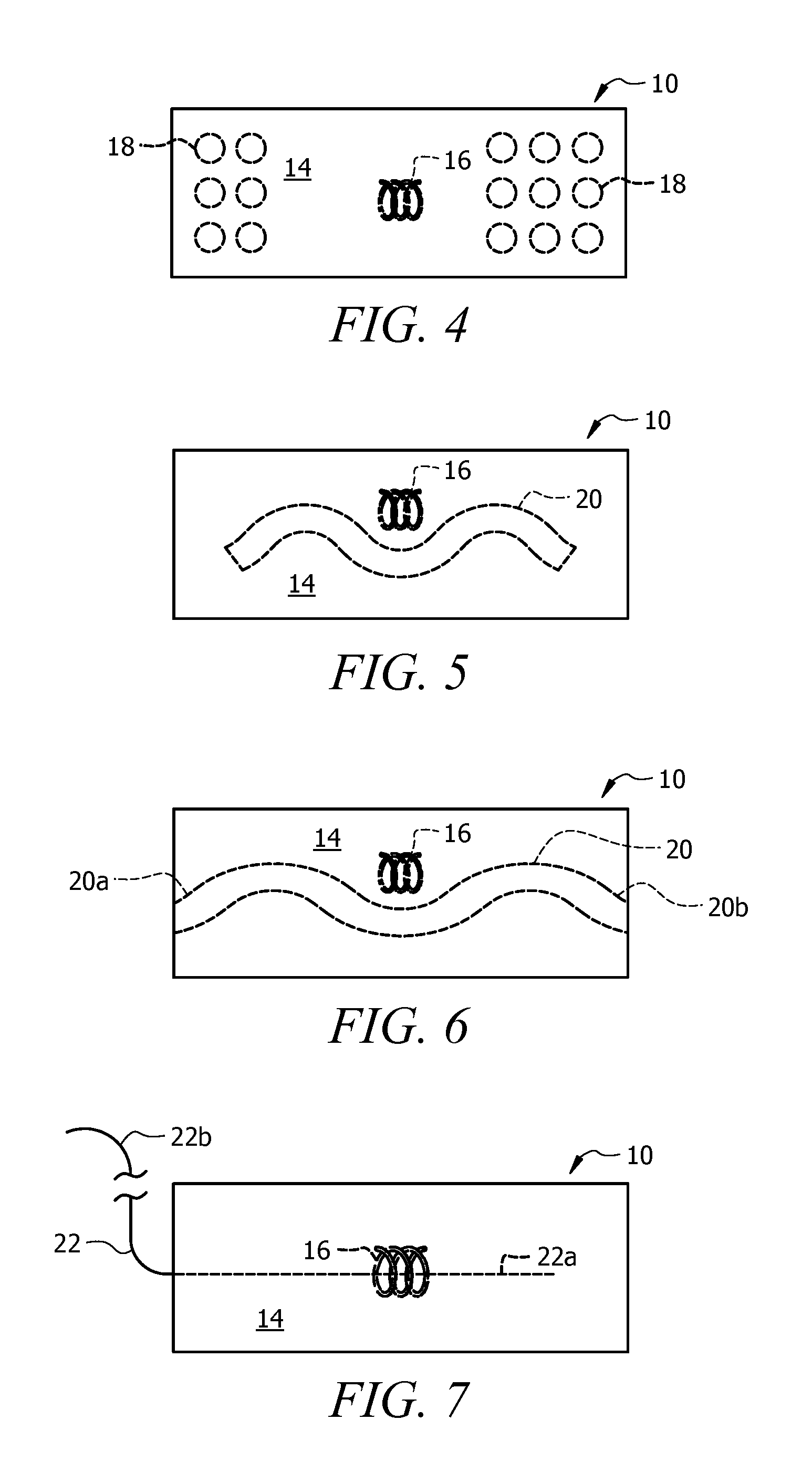 Method of Enhancing Ultrasound Visibility of Hyperechoic Materials