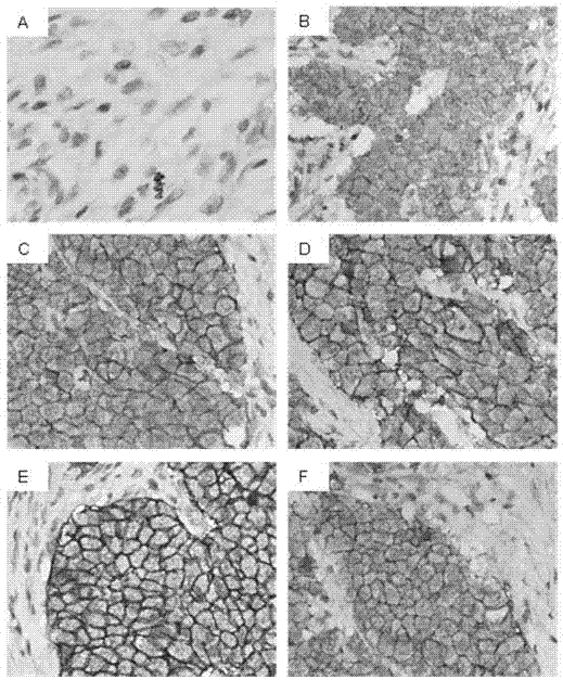 Antigen pre-processing method for preparing antibody