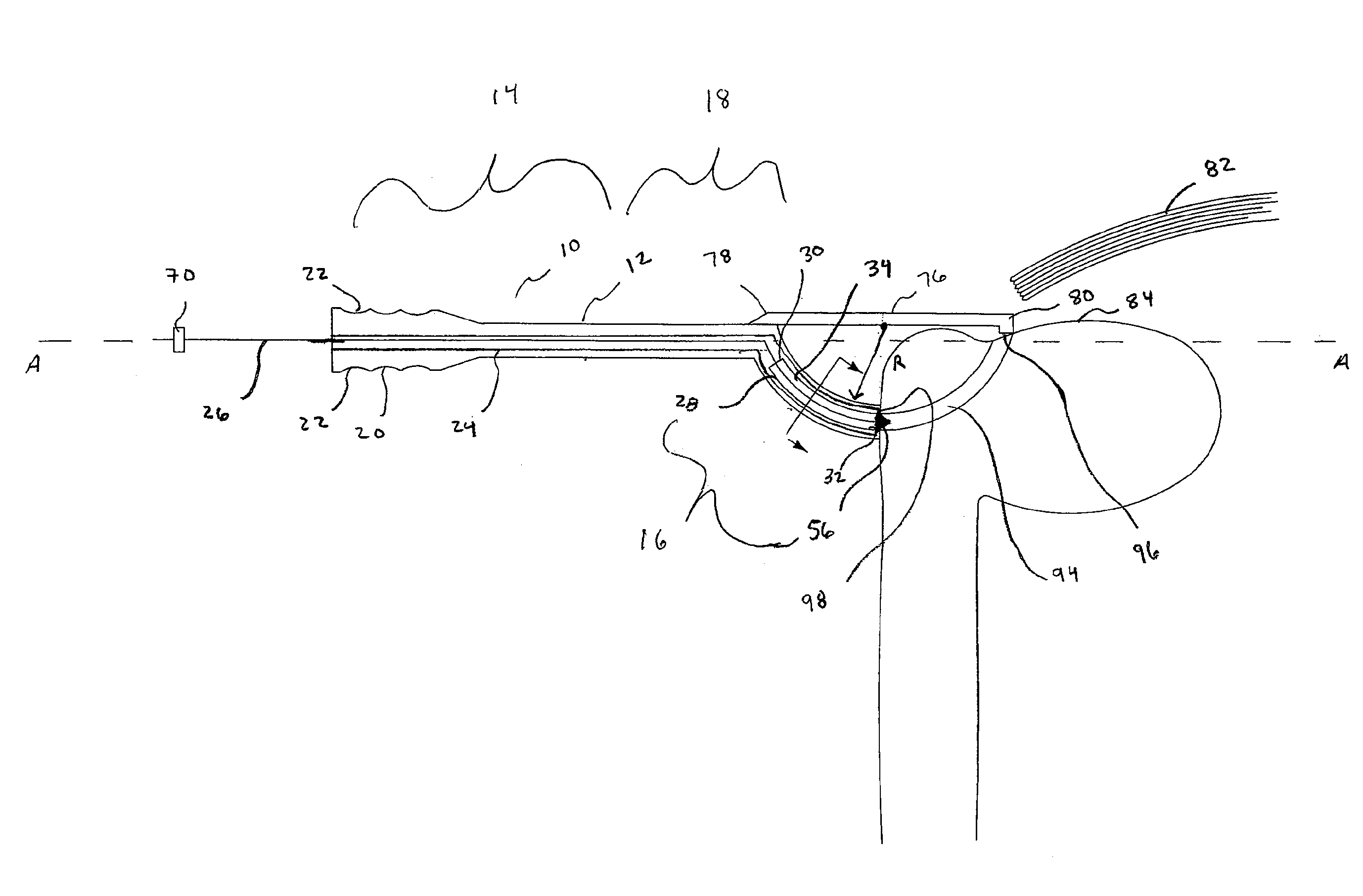 Arthroscopic tunnel guide for rotator cuff repair