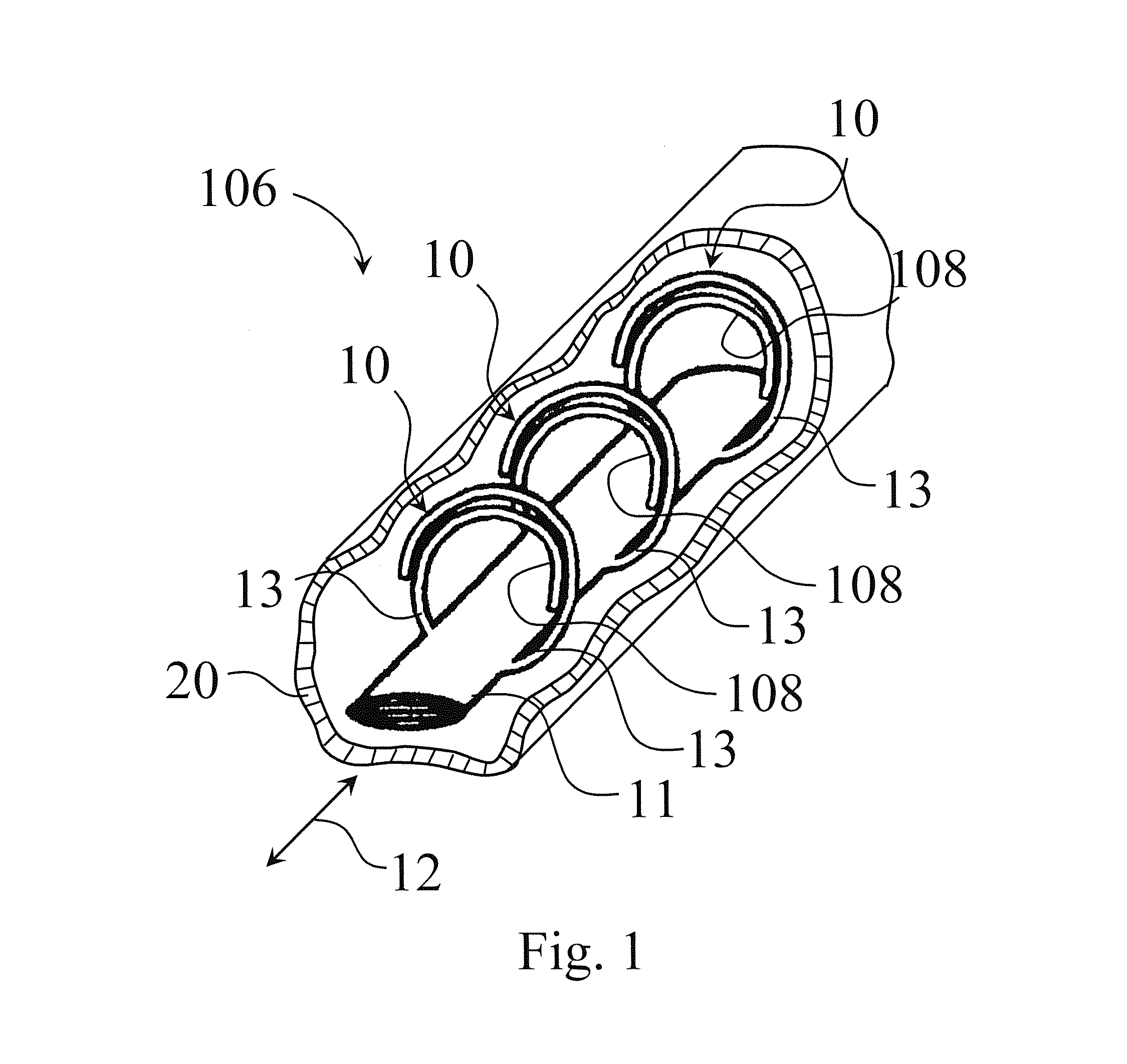 Endovascular electrode system for tissue stimulation