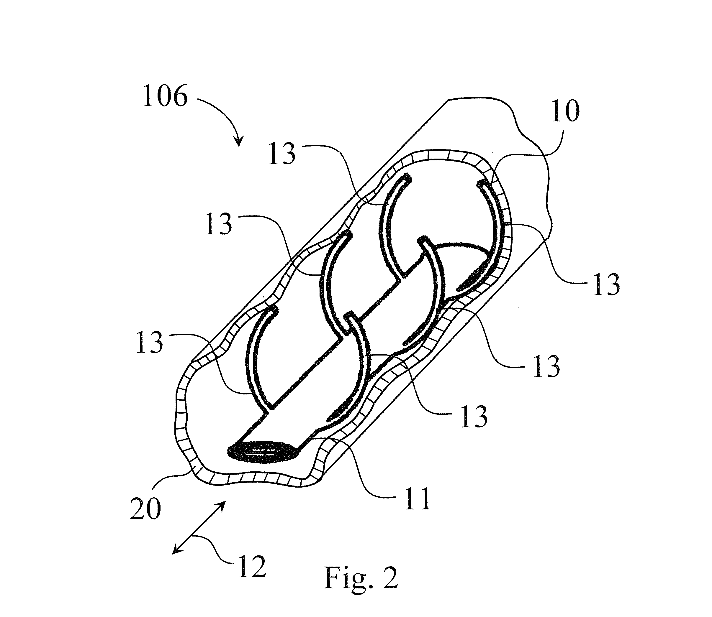 Endovascular electrode system for tissue stimulation