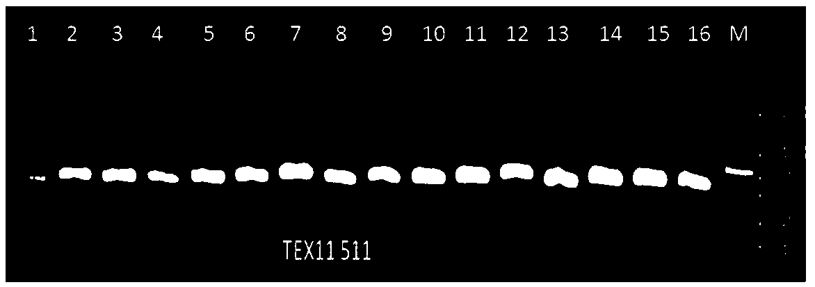 Method and primer for detecting 8th and 25th whole exons of TEX11 gene