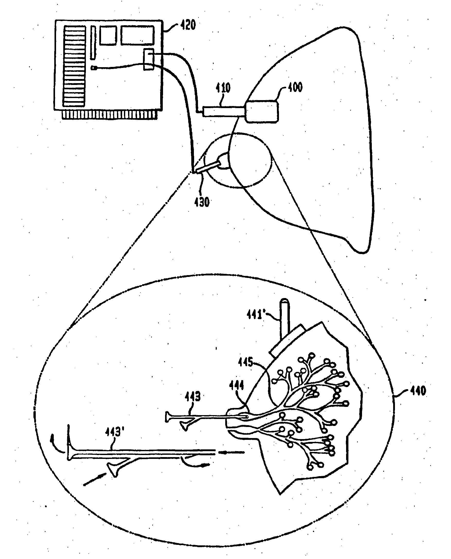 Method and System for Detecting Electrophysiological Changes in Pre-Cancerous and Cancerous Tissue and Epithelium