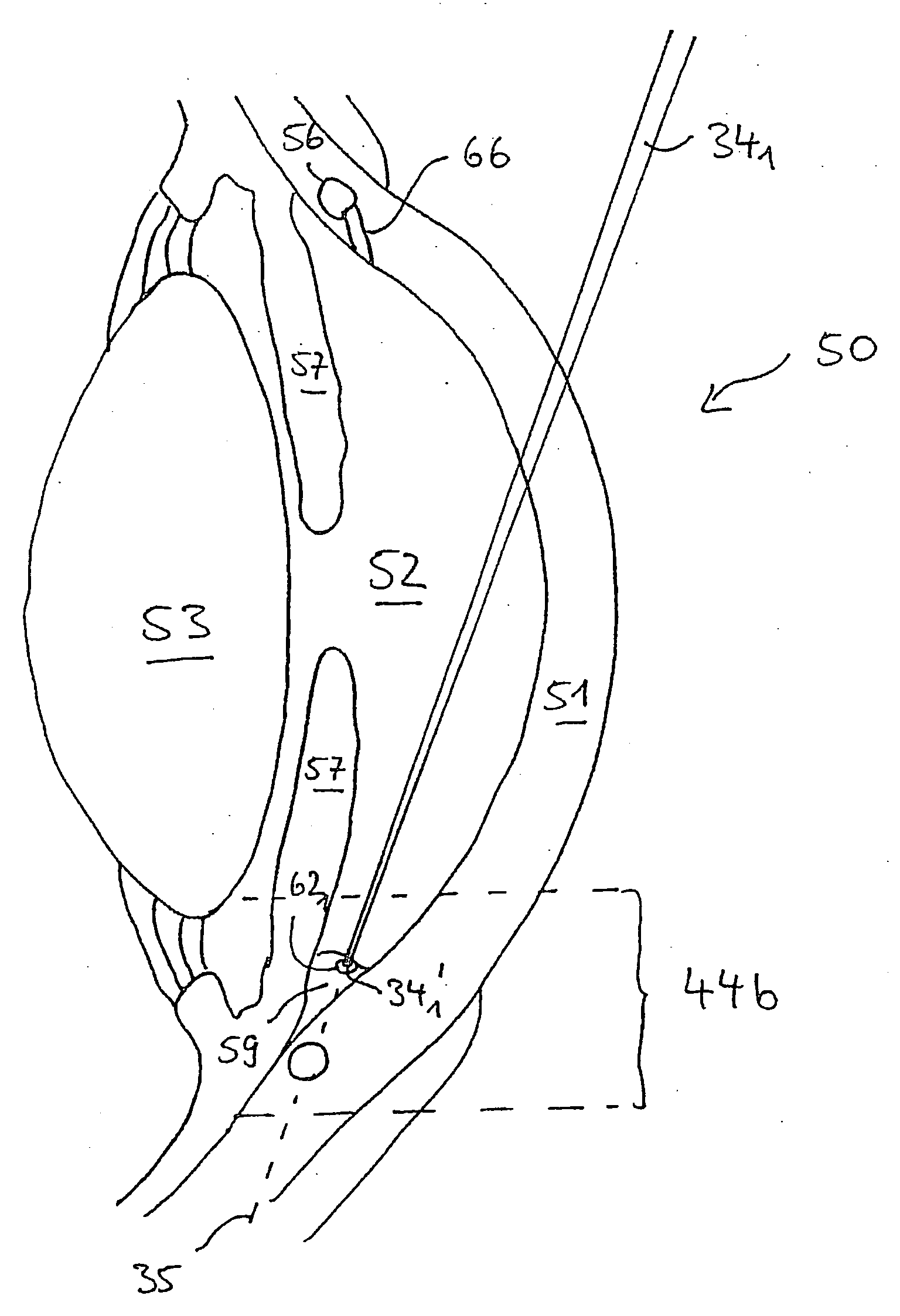 Systems and methods for treating glaucoma and systems and methods for imaging a portion of an eye