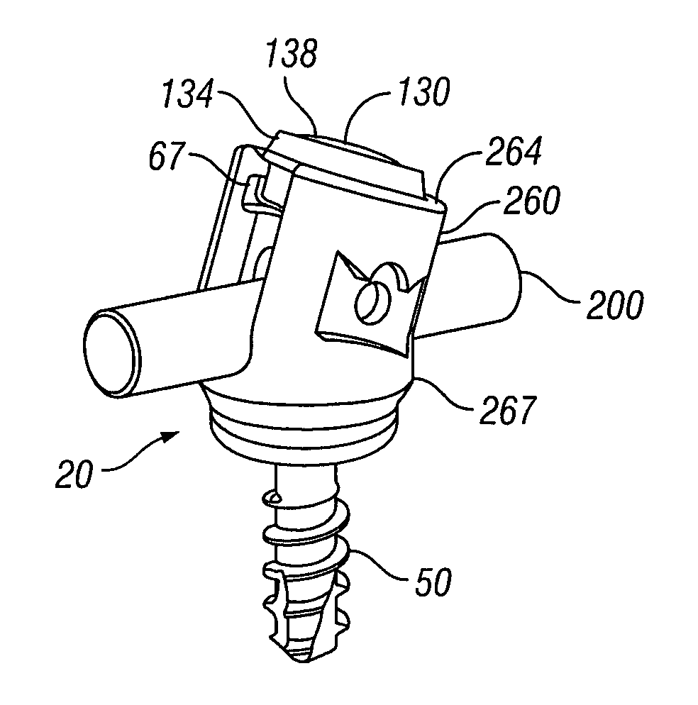 Bone Screw Assembly