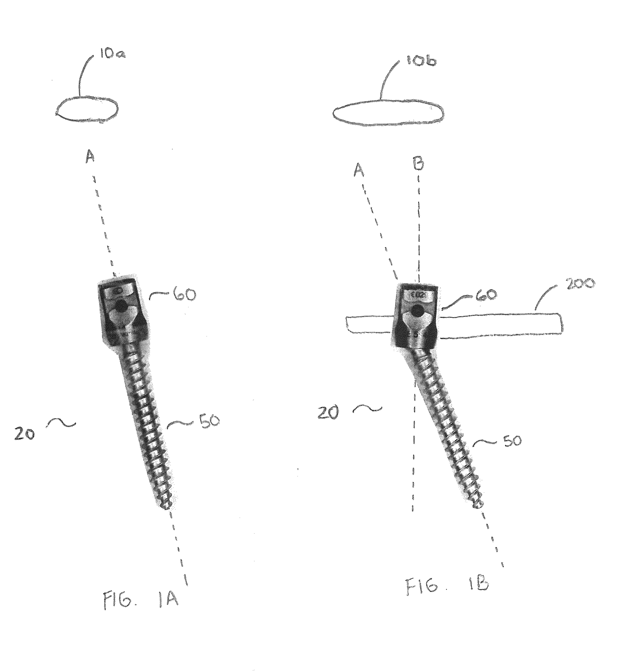 Bone Screw Assembly