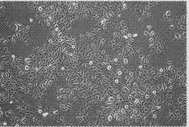 Serum-free culture medium system for culture of primary human epidermic cells