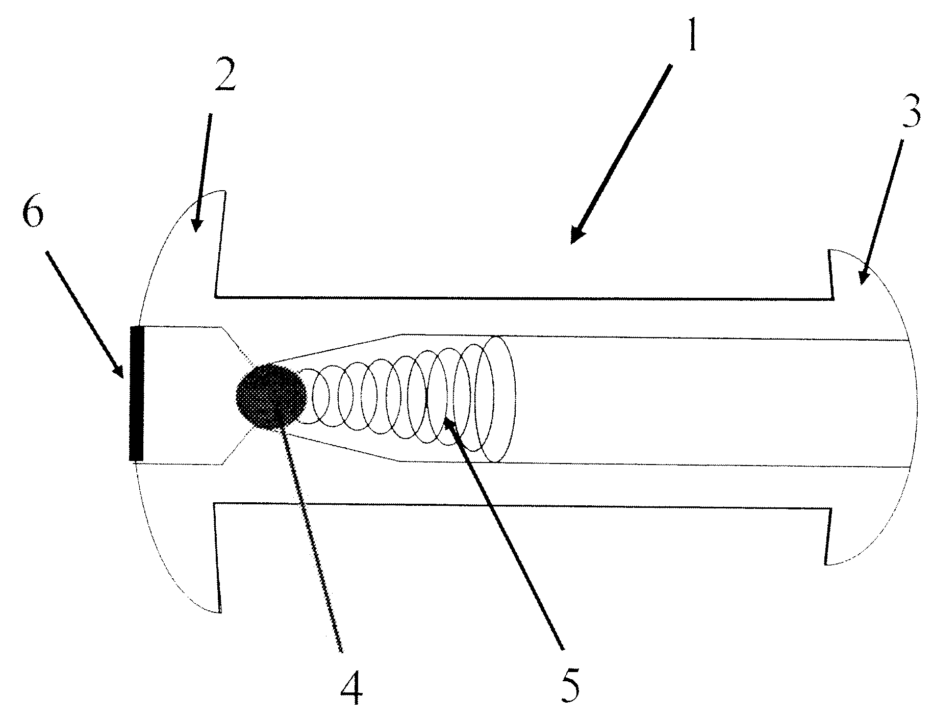 Vesicular shunt for the drainage of excess fluid