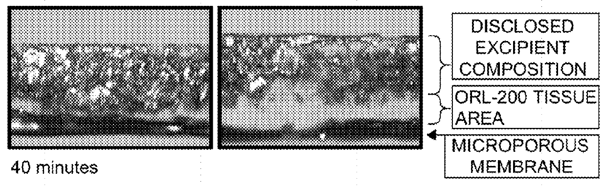 Excipient compositions for mucoadhesive pharmaceutical compositions including a synergistic combination of amylopectin, pullulan, hyaluronic acid, and xyloglucan