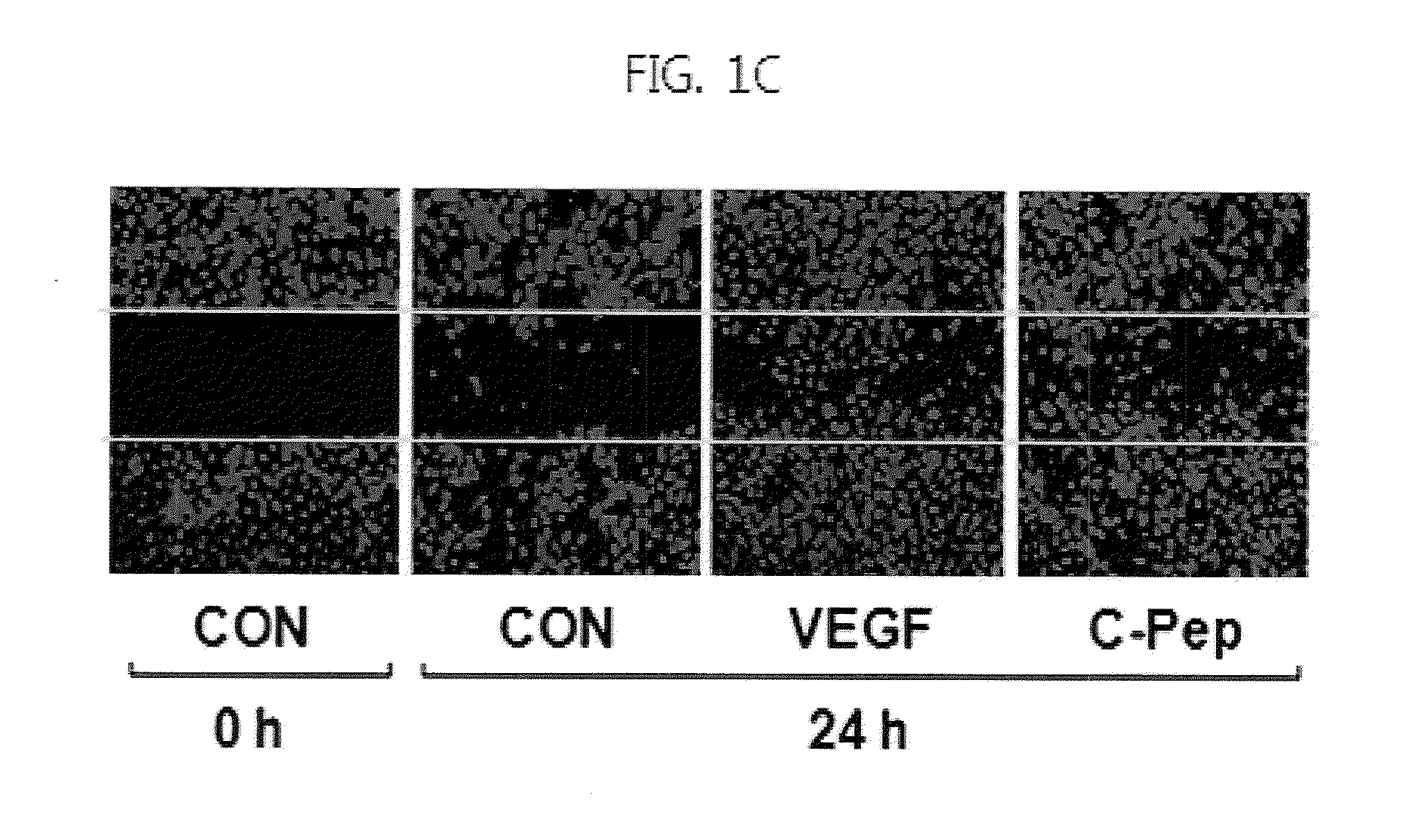 Method for prevention or treatment of diabetic angiogenesis impairment using C-peptide