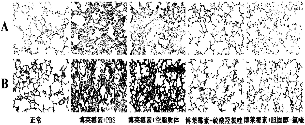 Chloroquine cholesterol derivative, and preparation method and application thereof