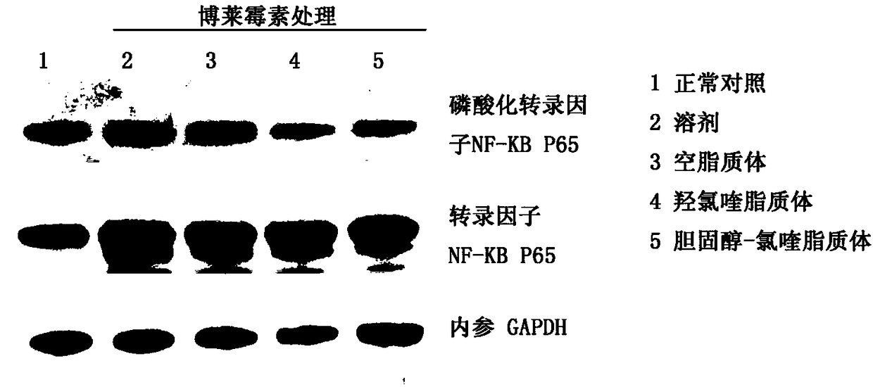 Chloroquine cholesterol derivative, and preparation method and application thereof