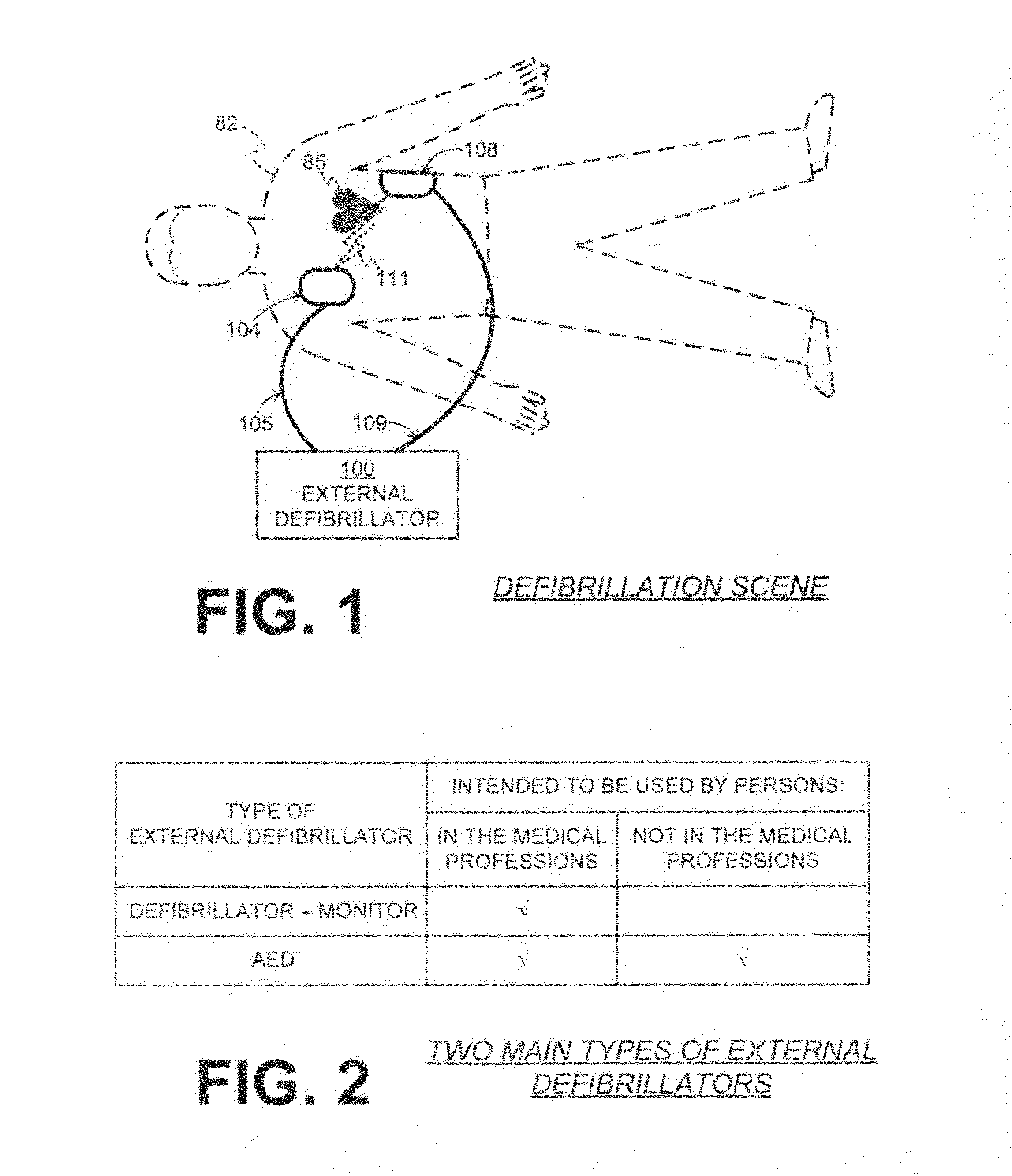 Filtering patient signal also for ventilation artifacts