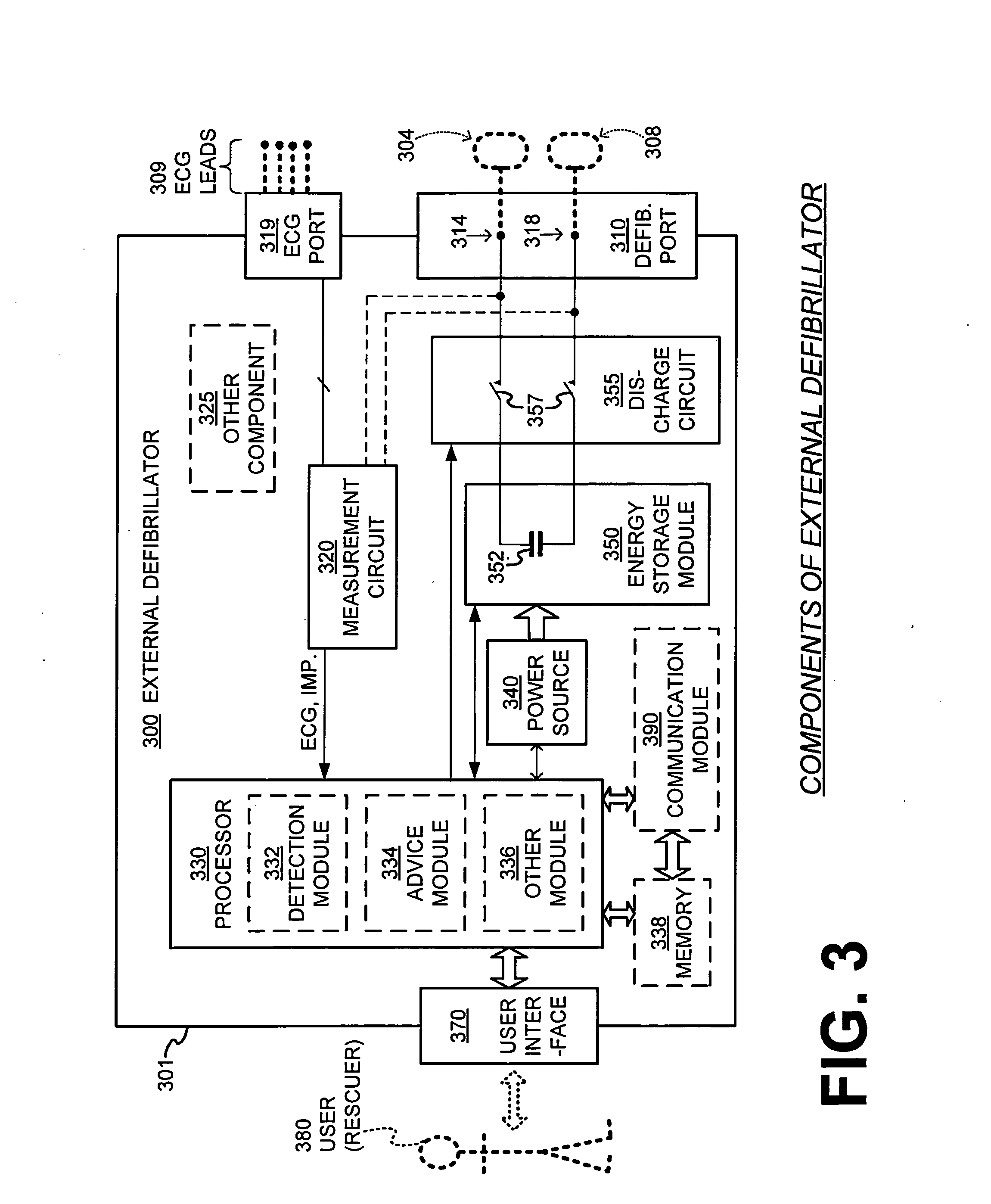 Filtering patient signal also for ventilation artifacts