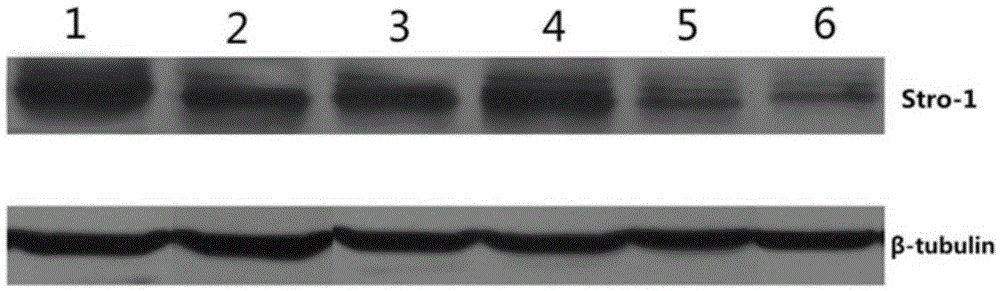 Culturing method of periodontal ligament stem cell