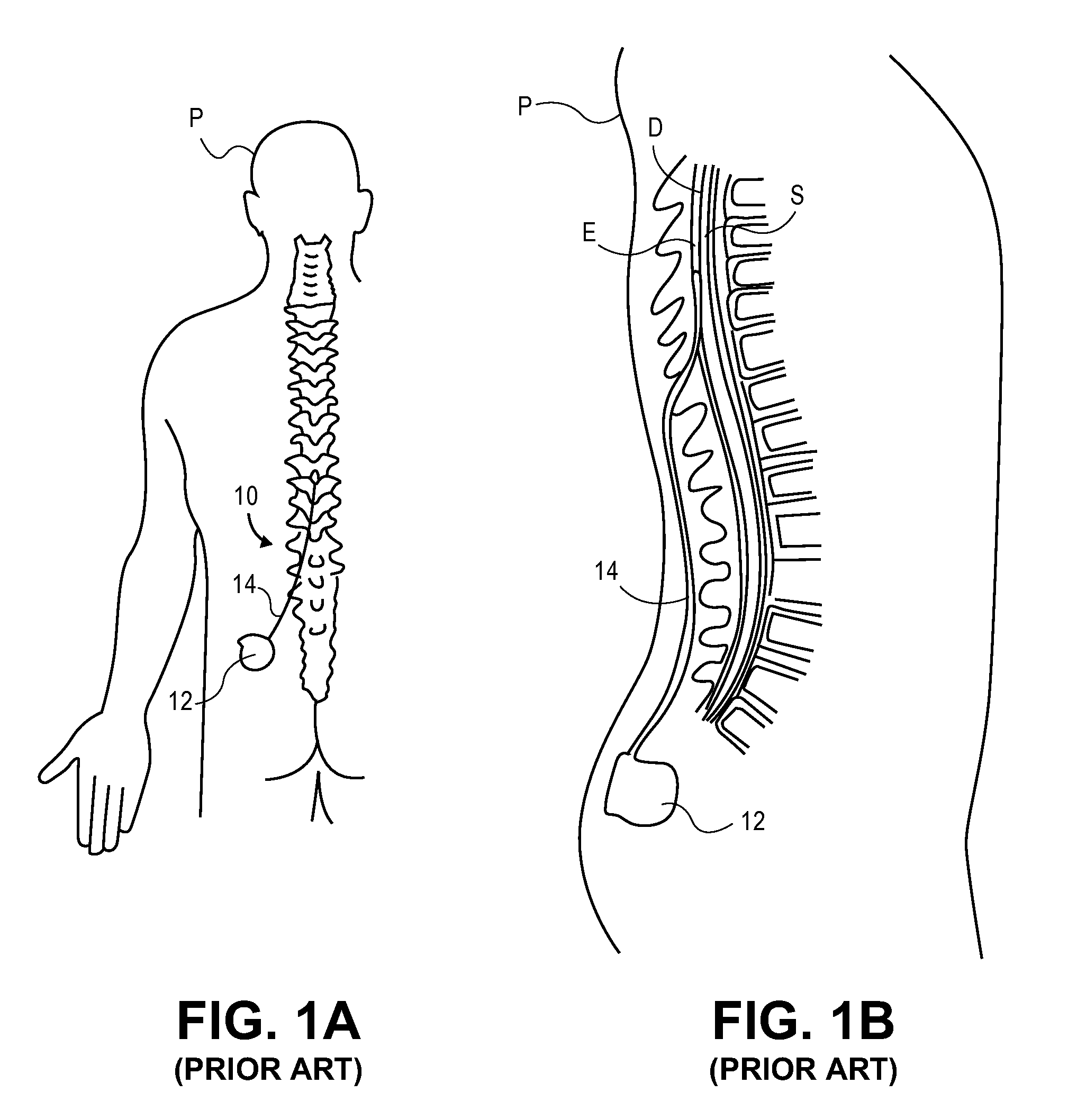 Selective stimulation systems and signal parameters for medical conditions