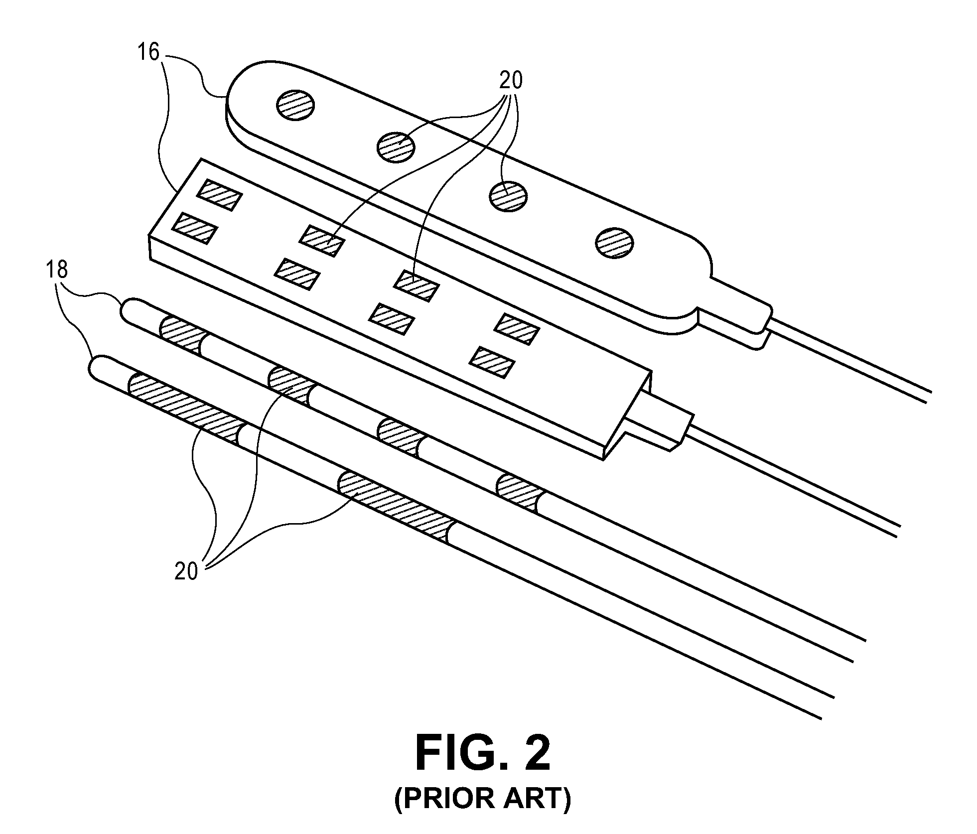 Selective stimulation systems and signal parameters for medical conditions