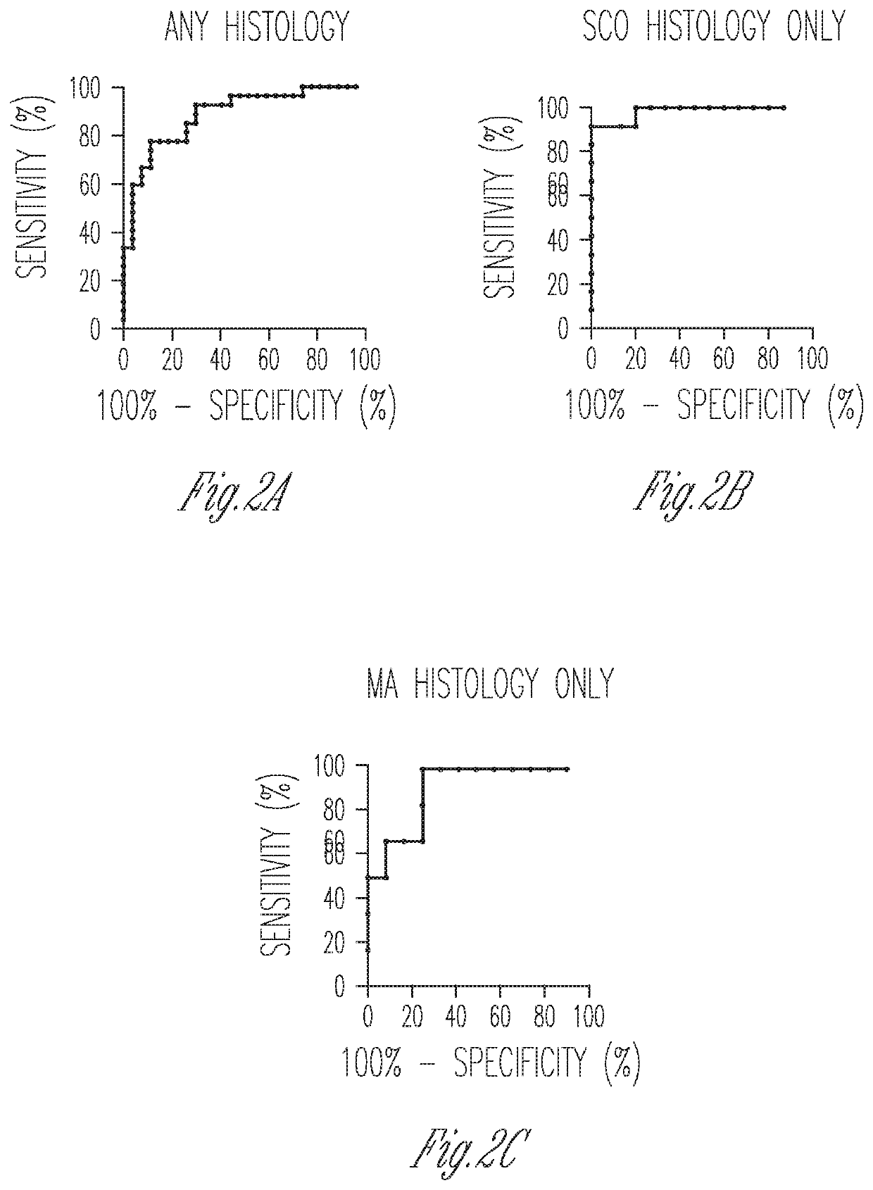 Method for successful retrieval of sperm