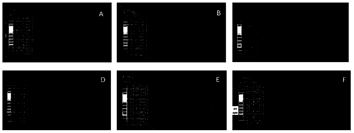 Novel bionic 3D printing bioactive fusion cage and preparation method thereof