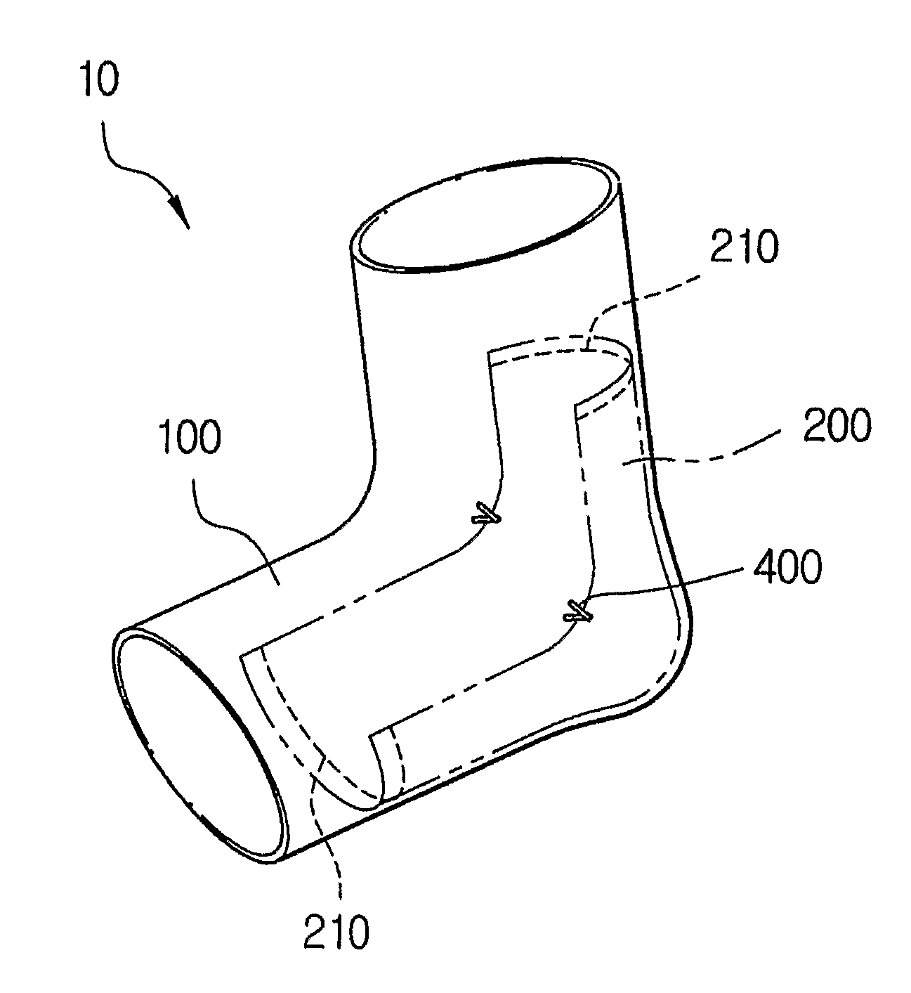 Heel protector