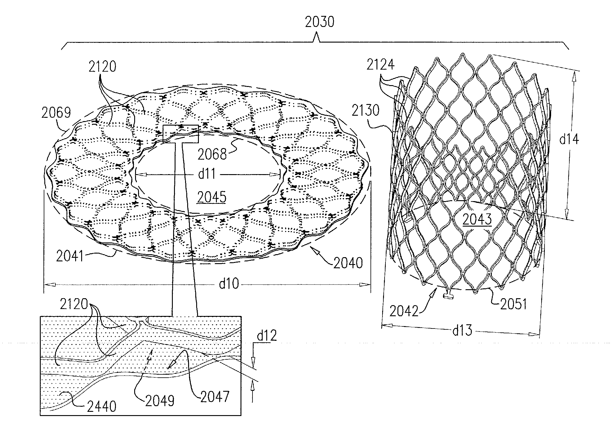 Techniques for percutaneous mitral valve replacement and sealing