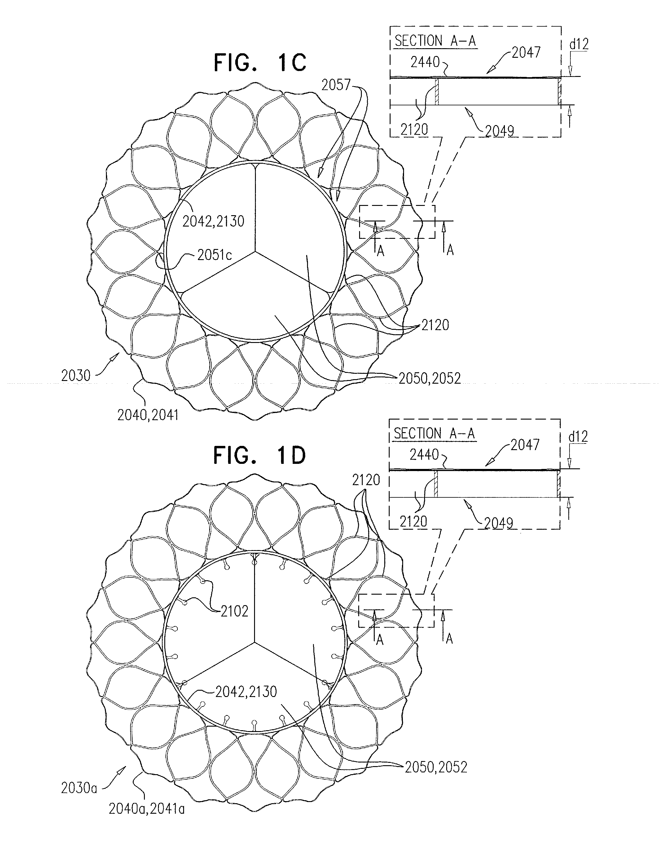 Techniques for percutaneous mitral valve replacement and sealing