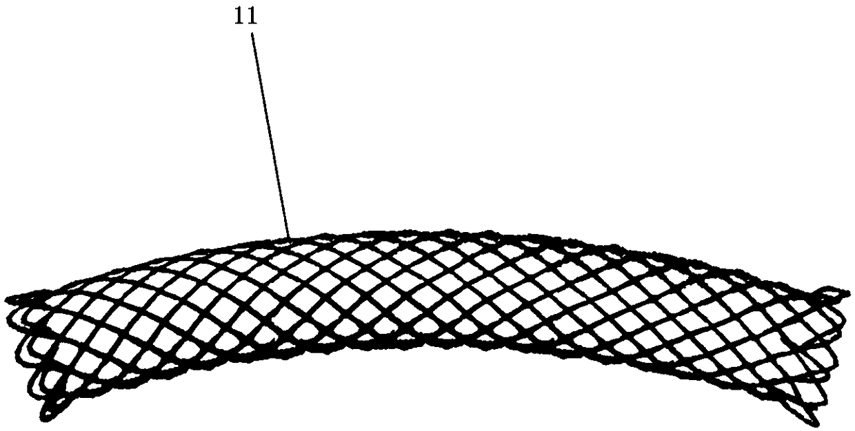 Intrahepatic bile duct coated stent and use method thereof