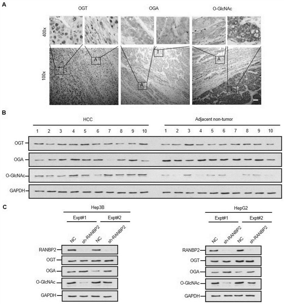 Application of cebpα as the target site of ranbp2 in the preparation of glycosylation drugs for the treatment of liver cancer