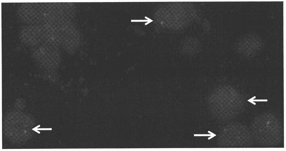 Aspl‑tfe3 fusion renal cancer gene probe and its kit application