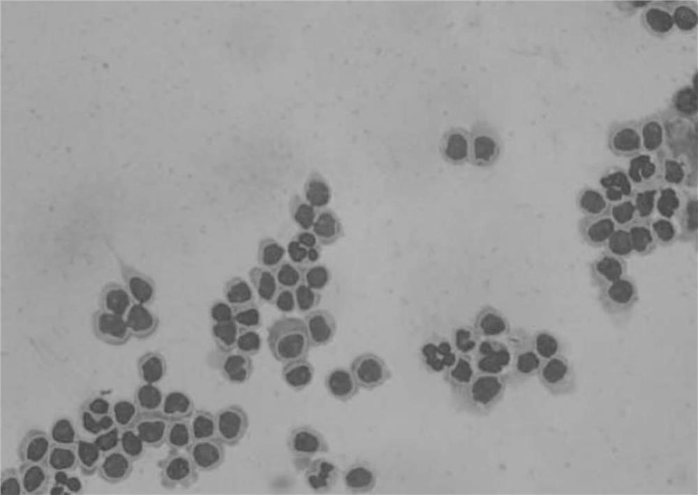 Cerebrospinal fluid cell feature extraction method based on gray level co-occurrence matrix