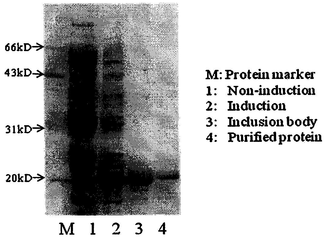 Human IgE (immunoglobulin E) Fab (fragment ab) against human and coding gene and application thereof