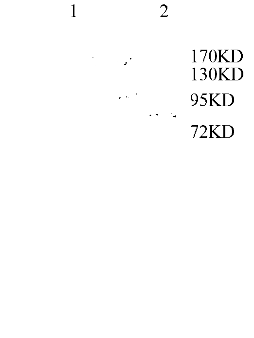 Bluetongue virus serum 1 (BTV1) VP2 protein monoclonal antibody (BTV1-3E8), B-cell epitope polypeptide identified by BTV1-3E8 and application of BTV1-3E8