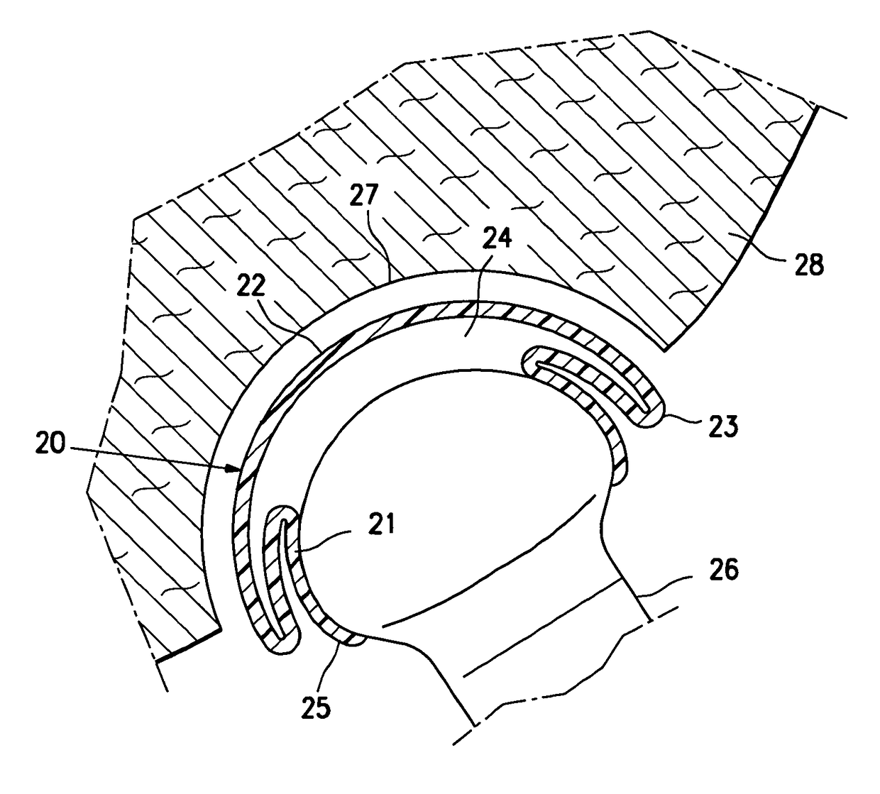 Resilient arthroplasty device