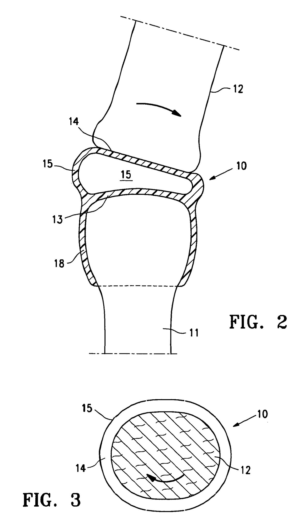 Resilient arthroplasty device